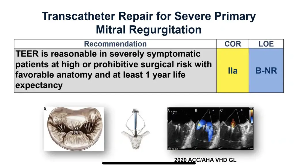 Transcatheter edge-to-edge repair (TEER) for severe primary MR